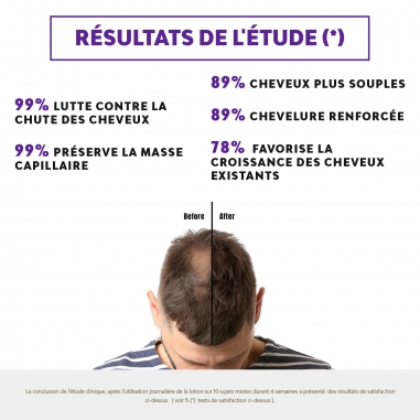 CCL+ - LOTION ANTI CHUTE EFFICACITÉ PROUVEE