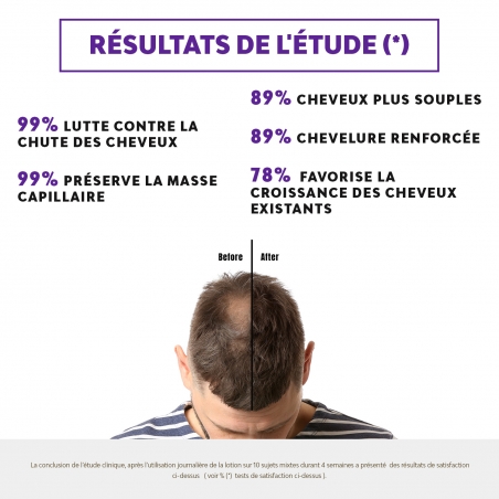 CCL+ - LOTION ANTI CHUTE EFFICACITÉ PROUVEE
