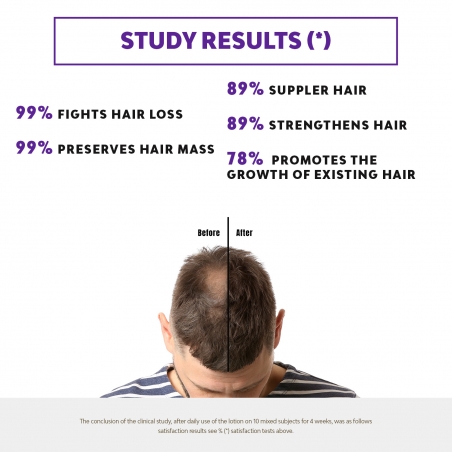 CCL+ - ANTI-FALL LOTION (PROVEN EFFICACY)