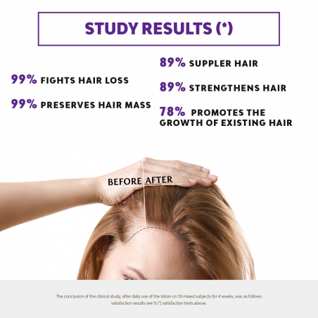 CCL+ - ANTI-FALL LOTION (PROVEN EFFICACY)